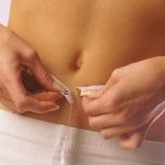 &#39;Abdominoplasty will help get rid of the &#39;apron&#39;