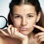 Allergic pimples - how to get rid of them?