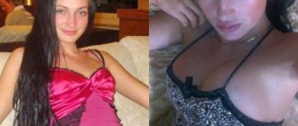 Evgenia Feofilaktova - photos before and after plastic surgery