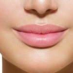 lips after augmentation