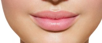 lips after augmentation