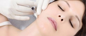 filler injections