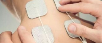 Iontophoresis for sweating