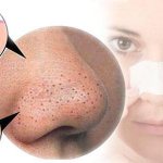 how to clean pores on nose