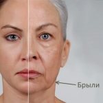 How to remove jowls on the face and restore the oval: exercises, procedures in cosmetology, gymnastics, facelift