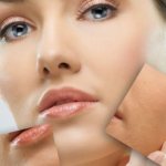 How to care for the surface of the skin after Fraxel