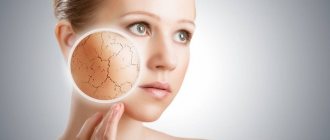 What factors affect facial skin?