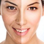When and why does skin start to age?