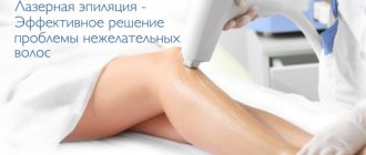 Laser hair removal of the deep bikini area. Contraindications, photos, price of the procedure 