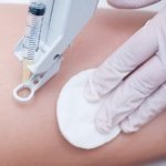 Medicinal mesotherapy against cellulite