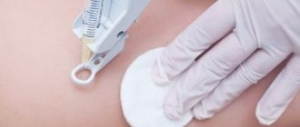 Medicinal mesotherapy against cellulite