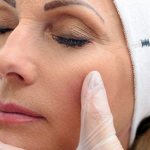 mesotherapy for bags under the eyes