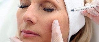 mesotherapy for bags under the eyes