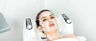 myostimulation of the face and neck