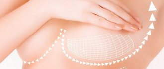 Thread breast lift: essence, effect, contraindications