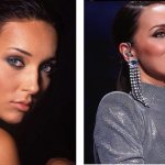 Alsou&#39;s nose before and after rhinoplasty