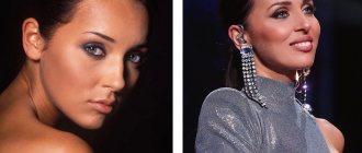 Alsou&#39;s nose before and after rhinoplasty