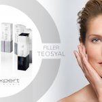 Review of the Teosyal filler line