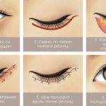 Plastic eye surgery: types of operations, prices, contraindications, recovery