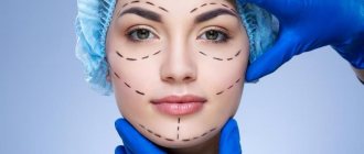 Facial plastic surgery