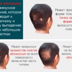 Плазмолифтинг головы для волос. Фото до и после, противопоказания, отзывы