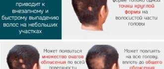 Плазмолифтинг головы для волос. Фото до и после, противопоказания, отзывы