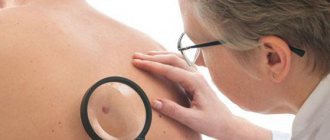 spots on the body due to uterine cancer