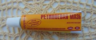 Retinoic ointment: is it effective against wrinkles, acne and blackheads. How to use ointment correctly and not cause harm 