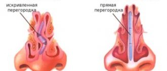 Septoplasty and vasotomy