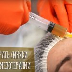 Tips from cosmetologists on how to quickly remove bruises after mesotherapy