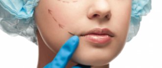 Modern plastic surgery: facelift - new methods and techniques