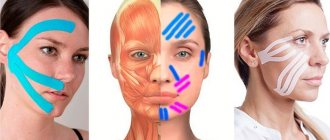 Тейпирование лицевых мышц