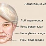 Types and classification of wrinkles