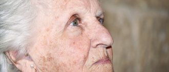 age spots on the face causes and treatment
